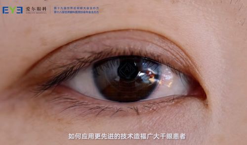 愛爾眼科疑難干眼癥診療中心覆蓋全國,打通全鏈路診療流程與服務